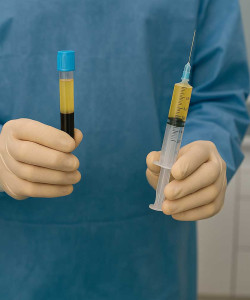 PRP (Platelet-Rich Plasma)